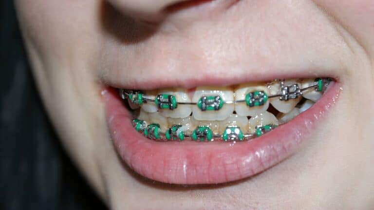 person wearing braces